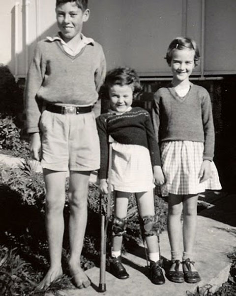 polio-survivor-i-wish-there-had-been-a-vaccine_embedded_1.jpg